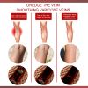 EELHOE Aricose Veins Medical Cream, Relieve Leg Swelling Earthworm Leg Vein Massage To Relieve Pain
