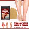 EELHOE Aricose Veins Medical Cream, Relieve Leg Swelling Earthworm Leg Vein Massage To Relieve Pain